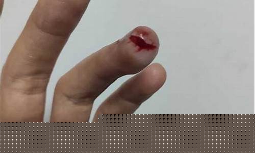 梦到自己手被割破流血(女人梦到自己手被割破流血)-命理之家