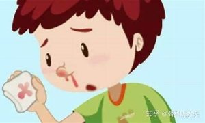 梦到自己流鼻血(梦见流鼻血是吉兆还是凶兆)-命理之家