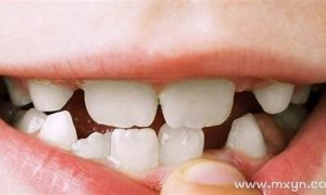 梦到掉牙齿是什么预兆(午睡梦到掉牙齿是什么预兆)-命理之家