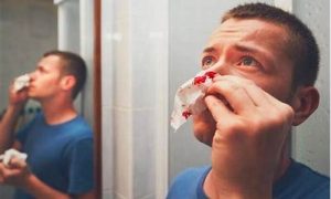 梦到自己流鼻血是什么预兆(为什么半夜会流鼻血)-命理之家