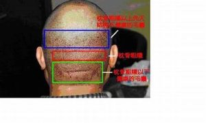 枕骨突出命运如何(枕骨突出怎么回事)-命理之家