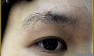 眉毛里有疤痕命运如何(眉毛里面有疤痕面相)-命理之家
