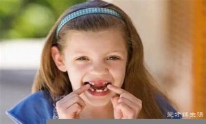 做梦梦到掉牙齿(做梦梦到掉牙齿是什么意思)-命理之家