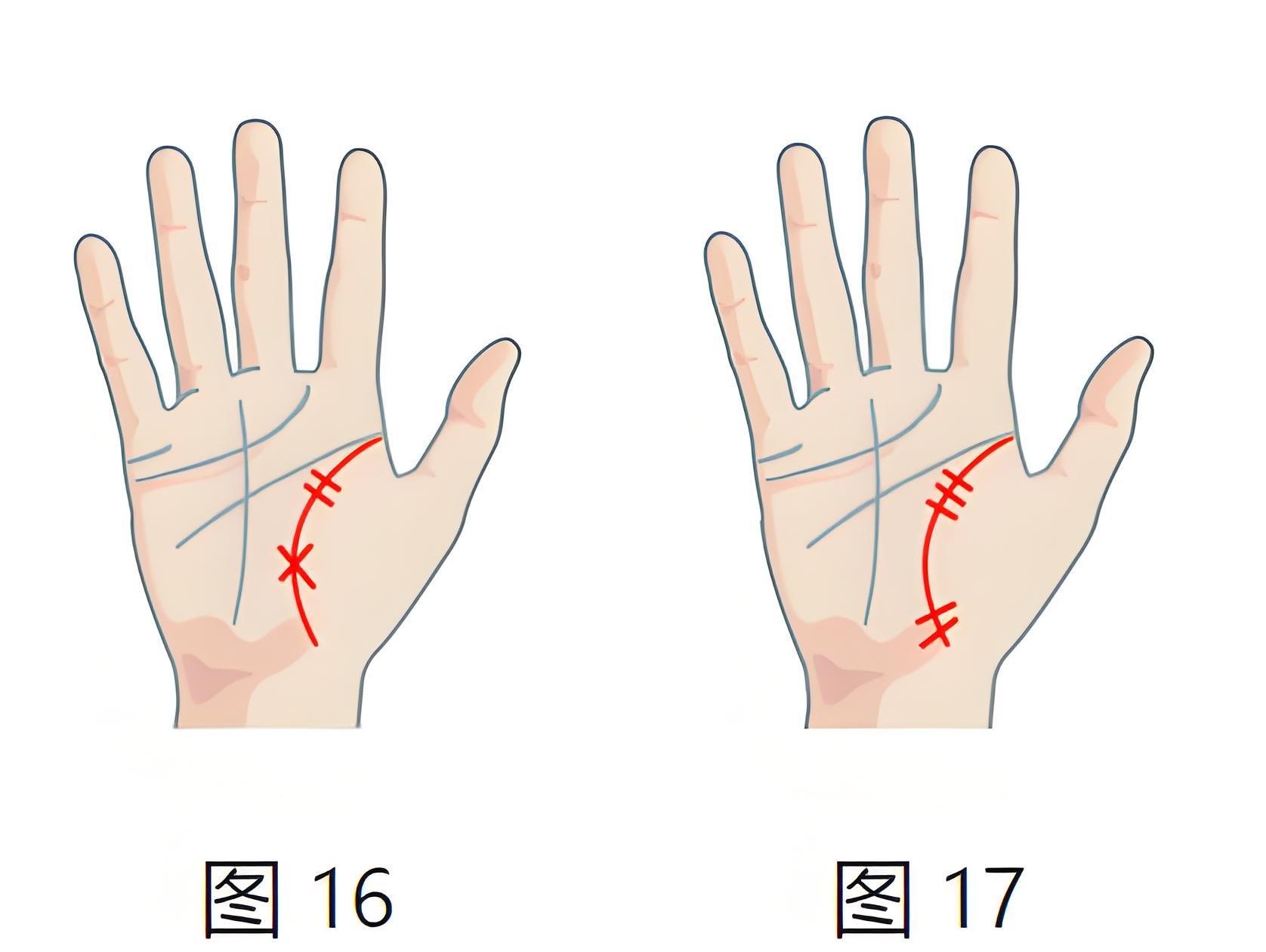 图片[6]-生命线位置与含义详解：掌纹看健康、寿命、疾病预兆全解析