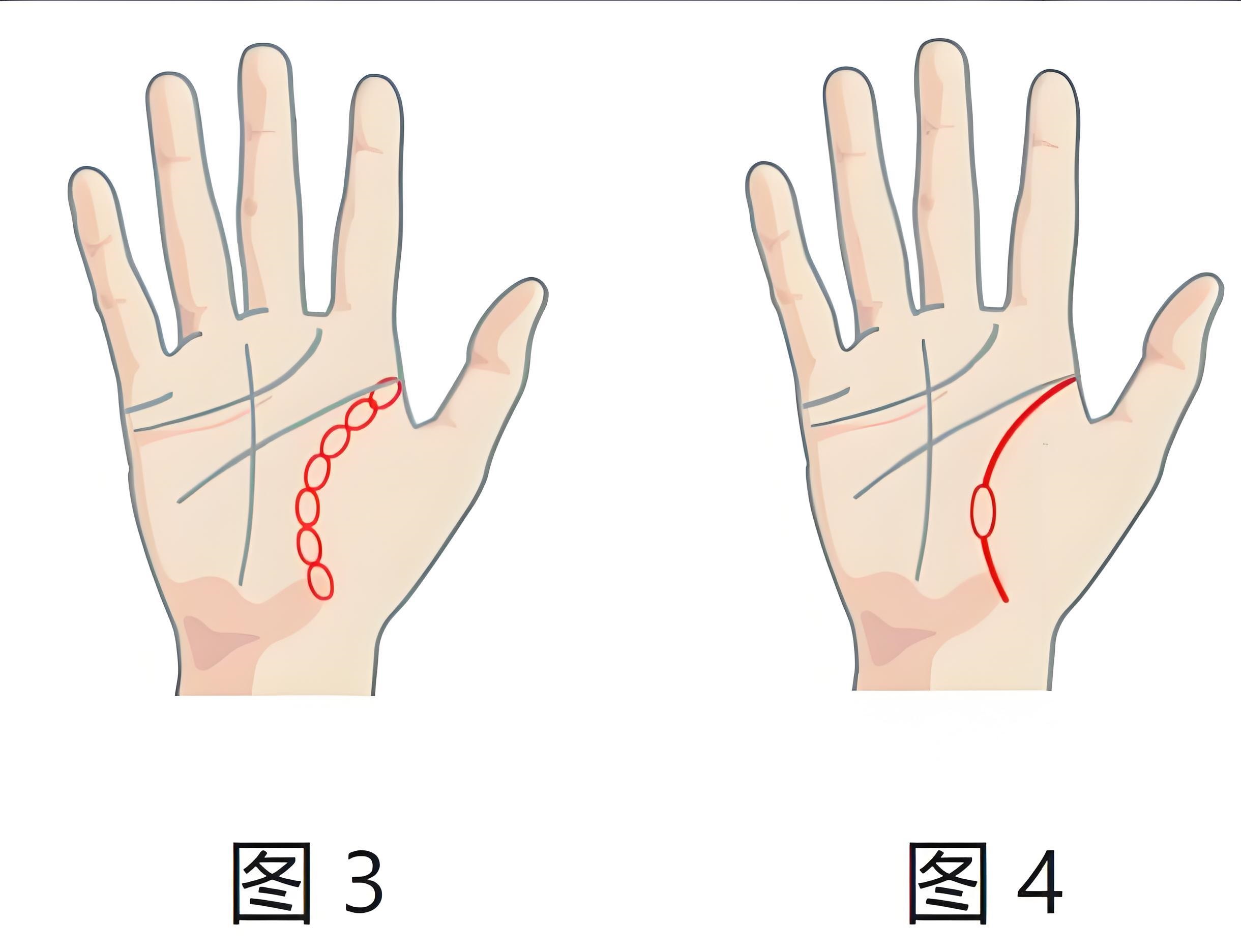 图片[5]-生命线位置与含义详解：掌纹看健康、寿命、疾病预兆全解析